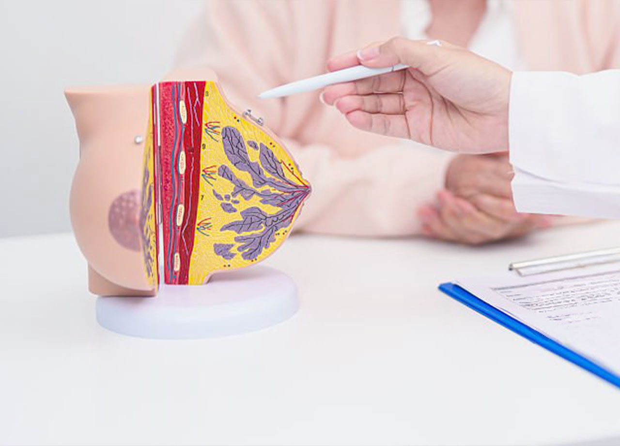 Brustkrebs Behandlung